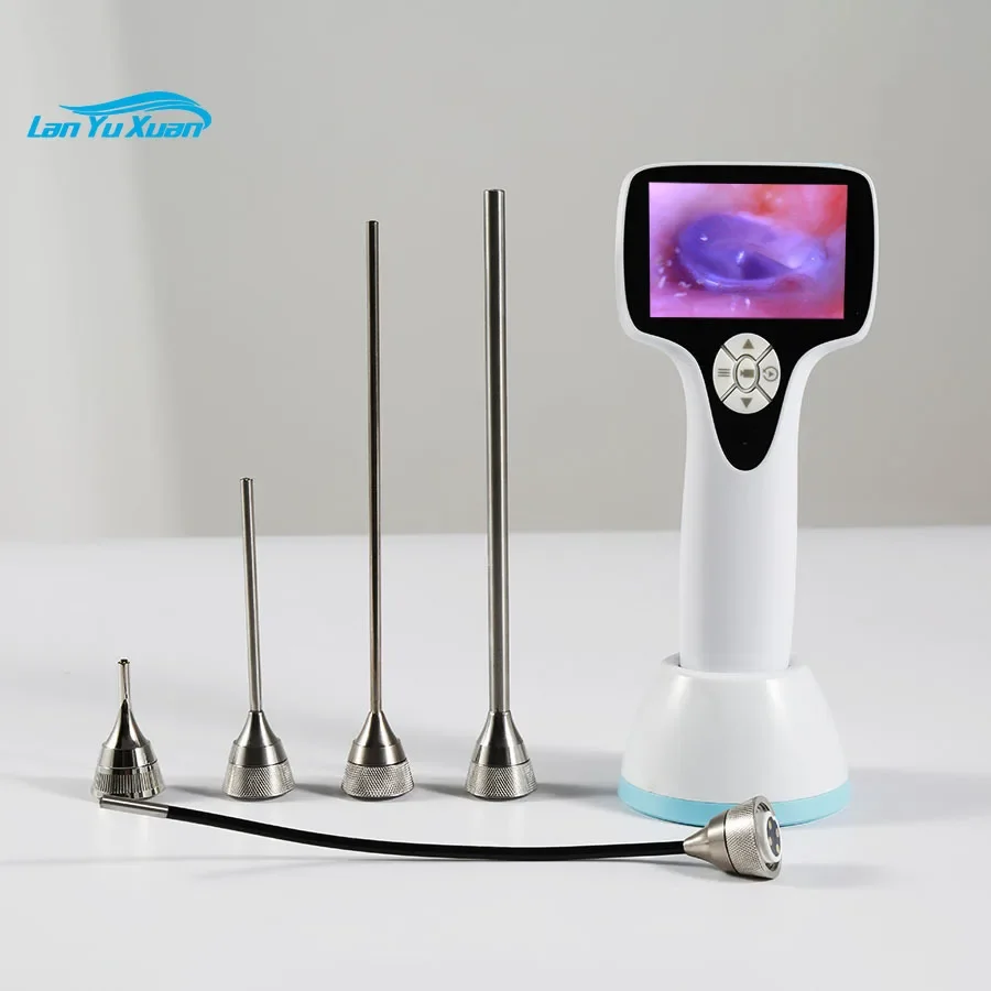 

Portable ENT endoscope system with 0 degrees 0 4mm wide angle for Ear Nose Throat Otolaryngology & veterinary