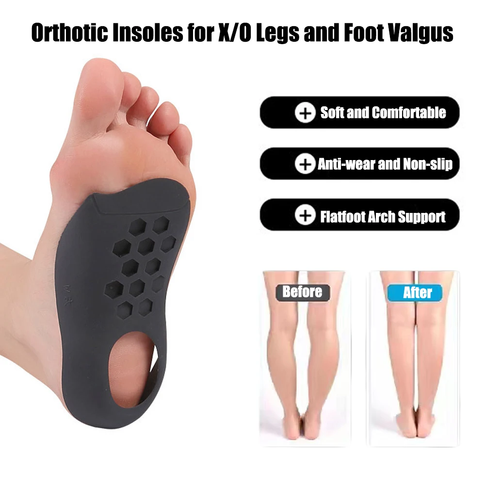 Orthotic Heel Insole with Arch Support Flat Feet Correction XO-Shaped Leg Foot Support Orthopedic Shoe Inserts for Shoes Unisex