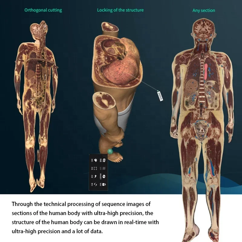 3D Body Virtual Autopsy Table Anatomage Digital Human Body Anatomy System for University
