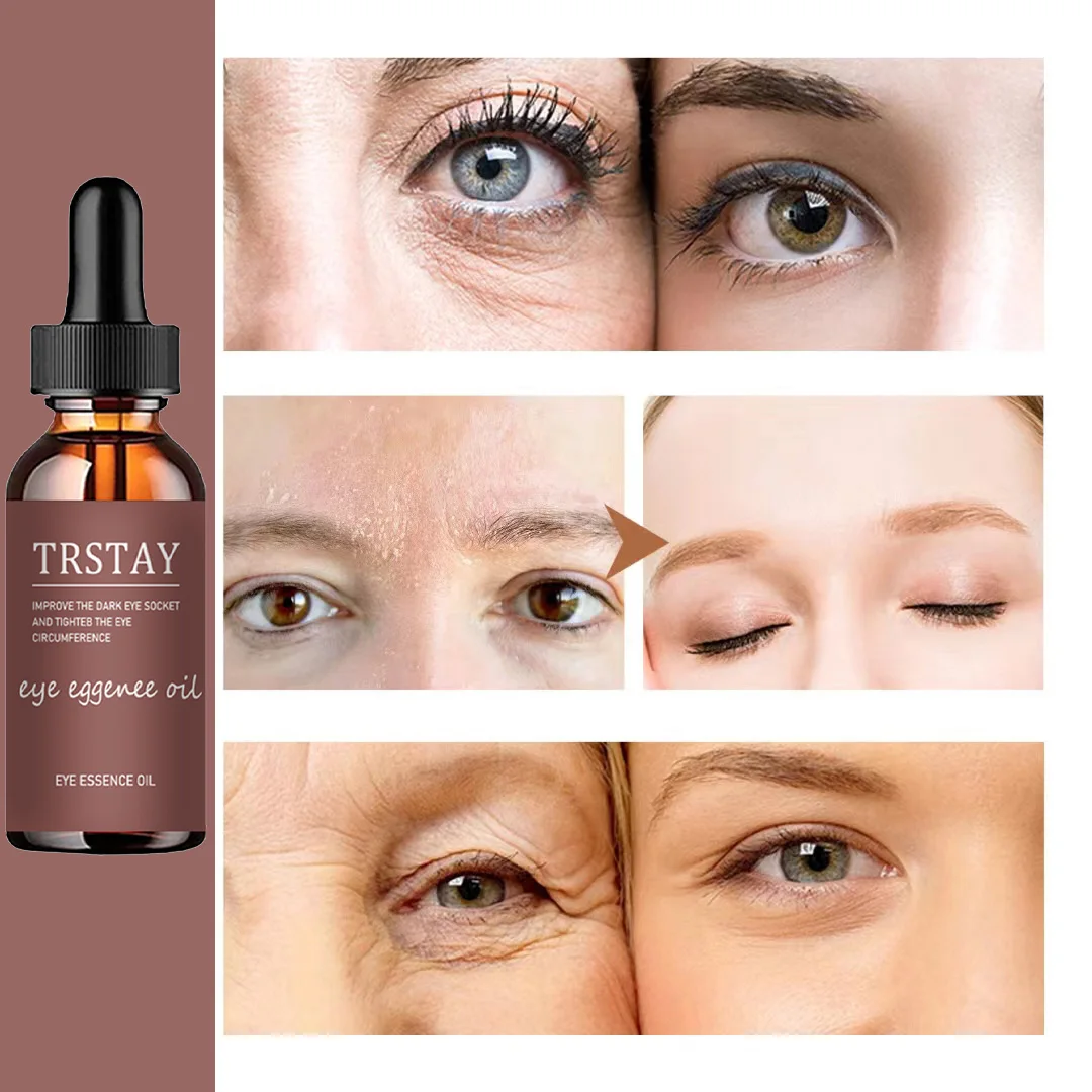 

TRSTAY essence oil for improving black eye socket and tightening eye circumference