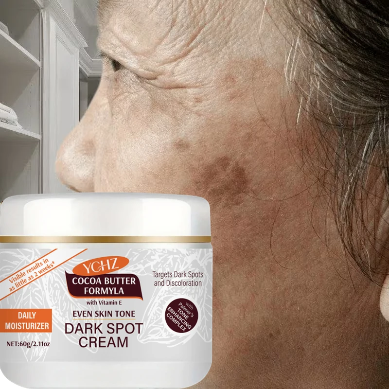 Instant Spot Removal Cream, Rich in Retinol, Vitamin E, and Various Active Ingredients, Effectively Fades Dark Spots, Brightens Skin Tone, and Imparts a Radiant Glow, with a Uniform Light Brown Tone Significantly Brigh