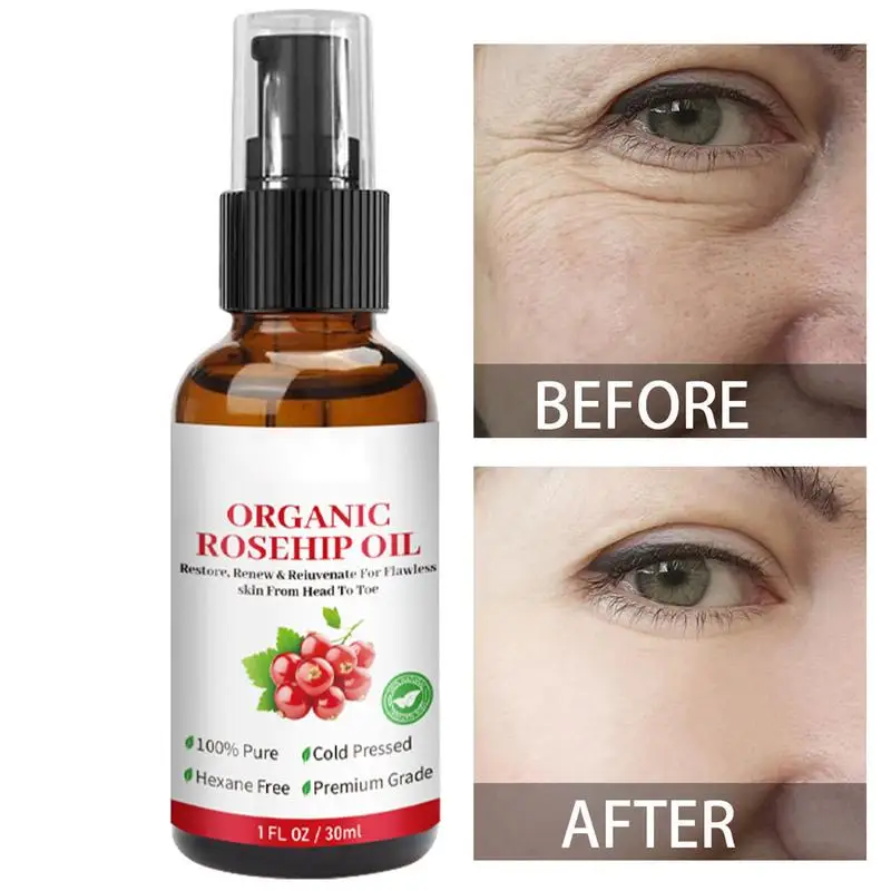 

Rosehip Oil Organic Rose Hips Face Oils 30ml Fast-Absorbing Skin Care Moisturizer Face Oil Organic Rosehip Seed Oil essence