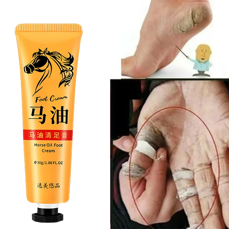 Vitamin E Urea Foot Cream Autumn Winter Moisturizing Hand And Feet Skin For Dry And Peeling Hand Softening Hand Feet Skin Care