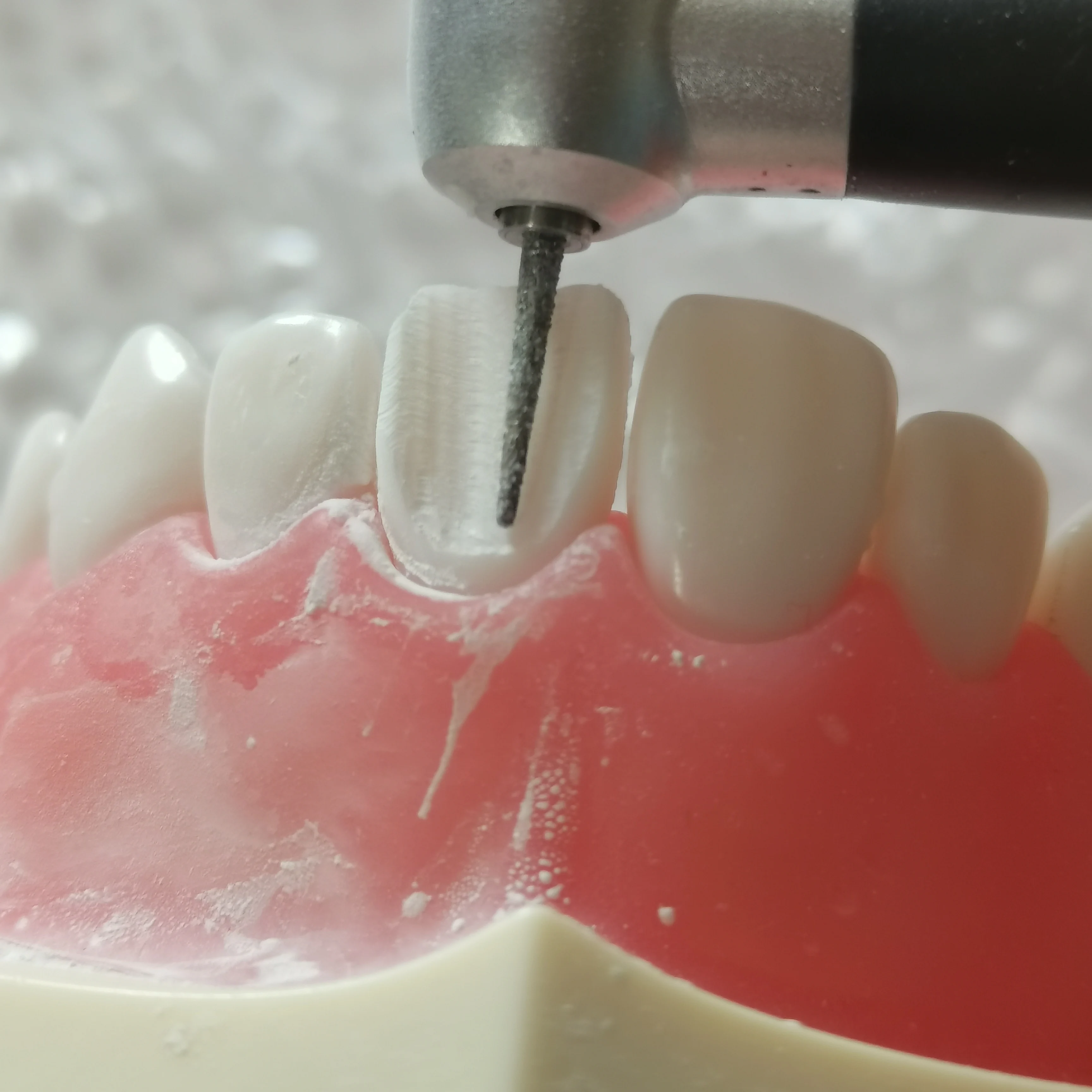 Model nauczania dentystyczny 28 wyjmowana śruba plastikowa Model Odontologia laboratorium narzędzia dydaktyczne produkty stomatologiczne 프라dnich
