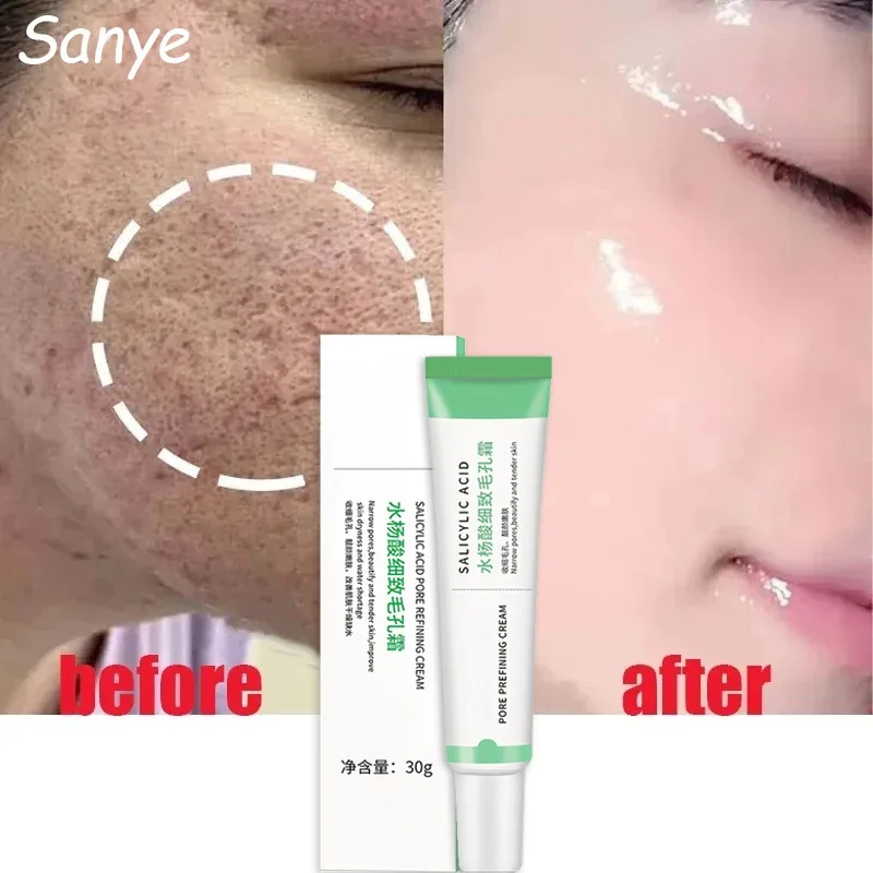 

Salicylic Acid Pore Shrinking Cream Quick Shrink Large Pores Remove Blackhead Moisturizing Face Smooth Skin Korean Care Products