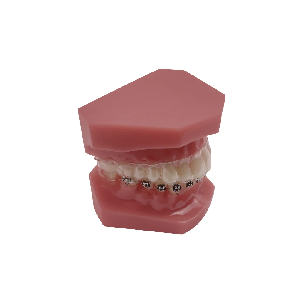 Modelo de dientes de ortodoncia Dental con retenedor, soporte Invisible, modelo de enseñanza Typodont para demostración de entrenamiento de odontología, 1 Uds.