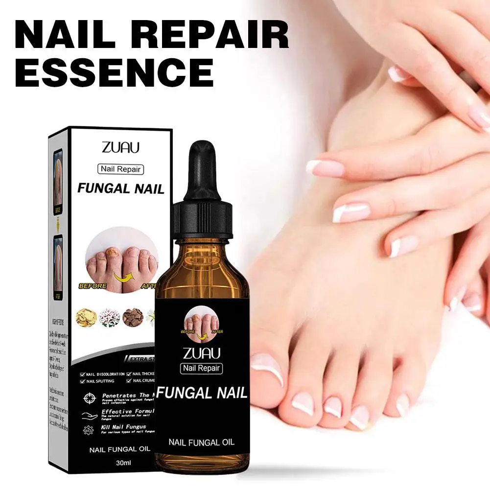 Nail Fungus Treatment Essence Anti Infection Paronychia Care Onychomycosis Hand 30ml Removal Foot Repair Fungal Nourishing J3J0