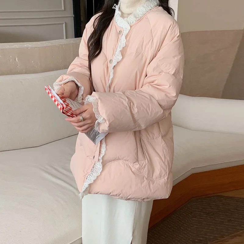 Winter New Women's Down Jacket Casual Lace Splicing Windproof Down Jacket