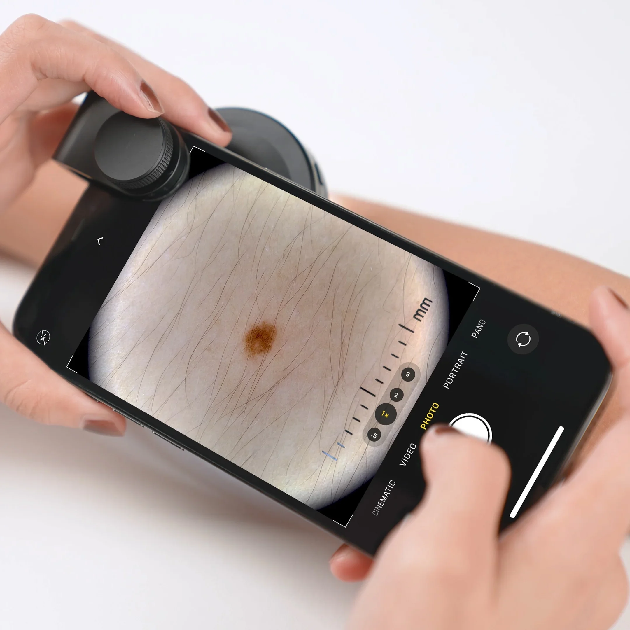 

DE-400 Portable USB Rechargeable Medical