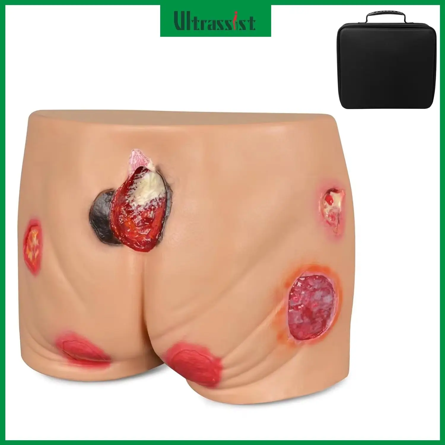 Ultrassist PVC Buttock Decubitus Ulcer Model Pressure Ulcer Wound Care Model Wound Care Education Tools for Medical Teaching