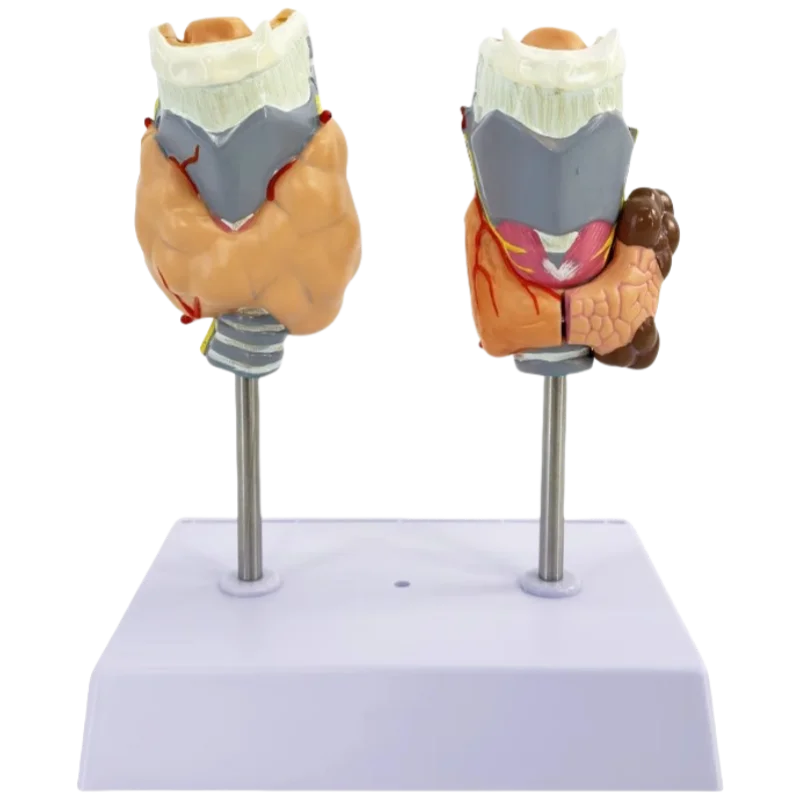 modelos-de-patologia-tiroides-para-ensenanza-medica-exhibicion-de-endocrinologia-de-enfermedades-tiroides-para-anatomia-medica
