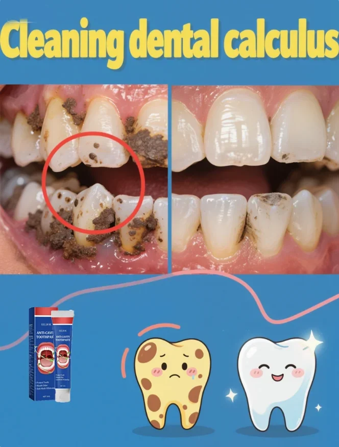 

Cavity killer，Gum repair toothpaste prevents tooth damage