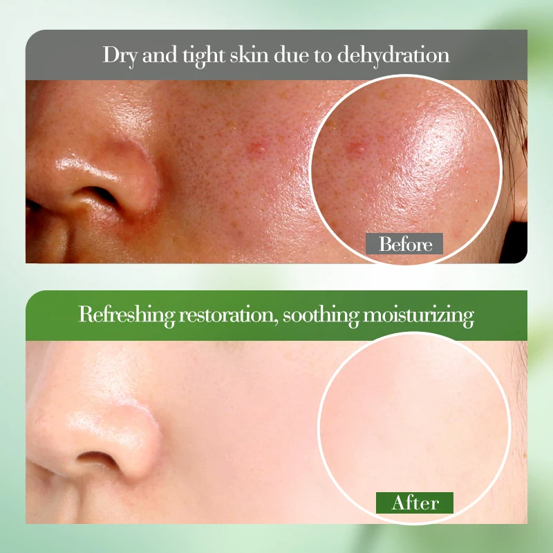 1/2/3 قطعة 50 مللي جل الصبار المرطب والمهدئ ترطيب مهدئ البشرة إصلاح عميق الألوة فيرا جل العناية بالبشرة العناية بالوجه