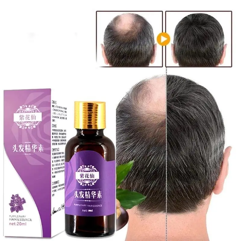 

Fast Hair Loss Products Natural with No Side Effects Grow Hair Regrowth Growth Serum Products Hair Care Essential Oils