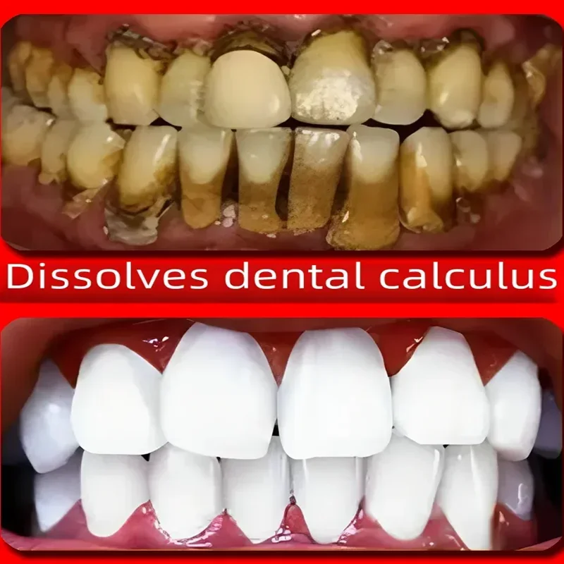 Dentifrice blanchissant pour probiotiques, élimination enzymatique de la pierre dentaire, prévention des odeurs buccales, parodontite, rafraîchit l'haleine, 2024