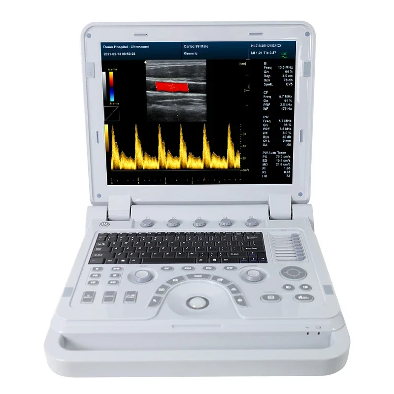 CONTEC live show handheld human Color Doppler Ultrasonic Diagnostic System digital ultrasound machine