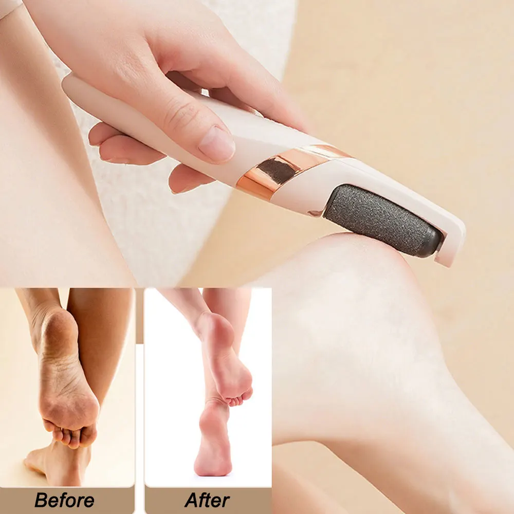 2 in 1 전기 굳은살 제거기 발 관리 도구 발 파일은 건조하고 거친 피부 굳은살을 제거합니다 충전식