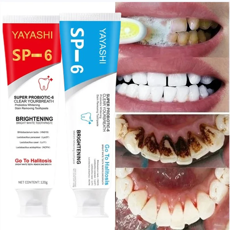 New SP-6 Probiotic Whitening Toothpaste Remove Dental Plaque Stains Oral Hygiene Clean Freshness Breath Teeth Whiten Agent