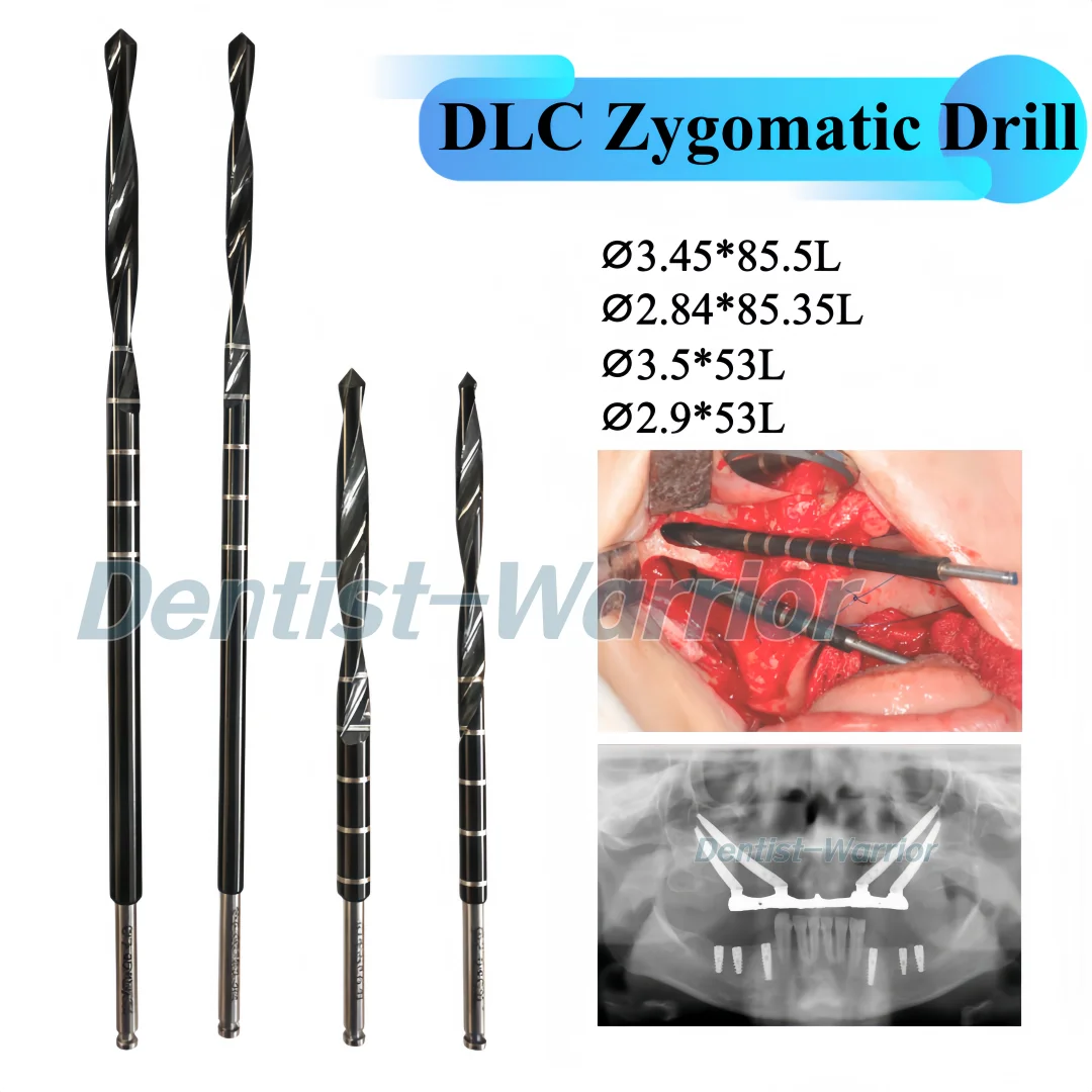 Dental Implants Dlc…