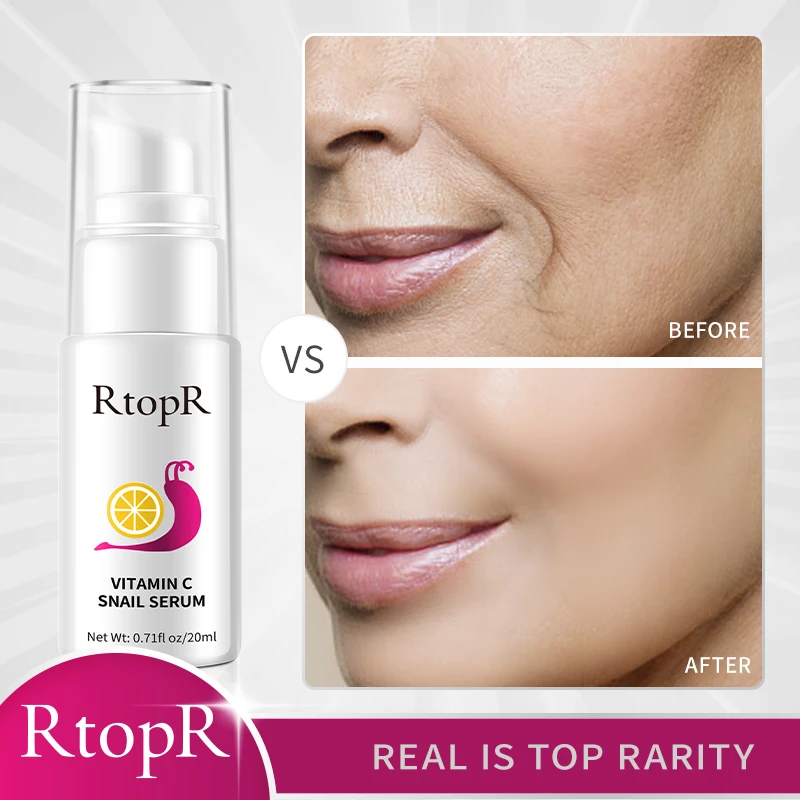 ビタミンCカタツムリエッセンス,アンチエイジング,しわ防止,毛穴の美白,保湿,オイルコントロール,フェイスケア