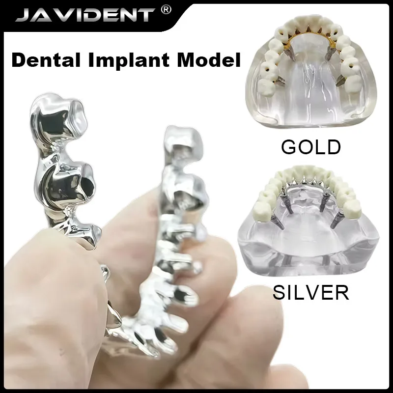 1Pcs Dental Implant Models | Upper Jaw Implant-Supported Dentures | Porcelain-Fused-to-Metal Bridges | Dental Supplies