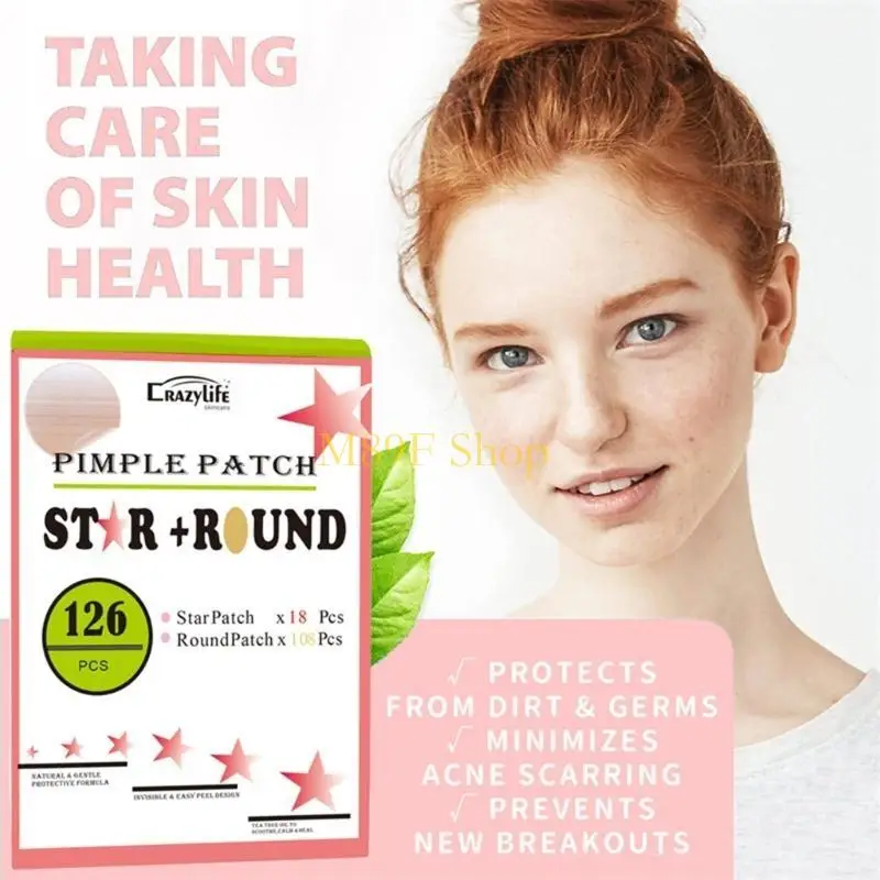 M89F 여드름 여드름 패치 염증성 여드름을 위한 반투명 하이드로콜로이드가 화이트헤드를 개선합니다