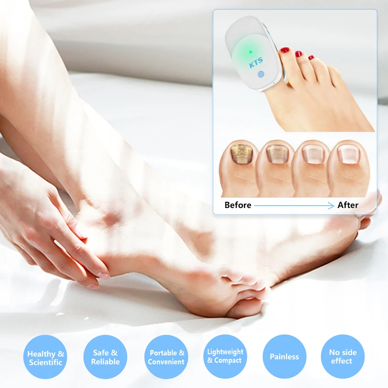 Fungal Nail Laser Device Repair Fast Nails Fungus Onychomycosis Repair Toenail Fingernail Removes Nail Fungus Foot Care Device