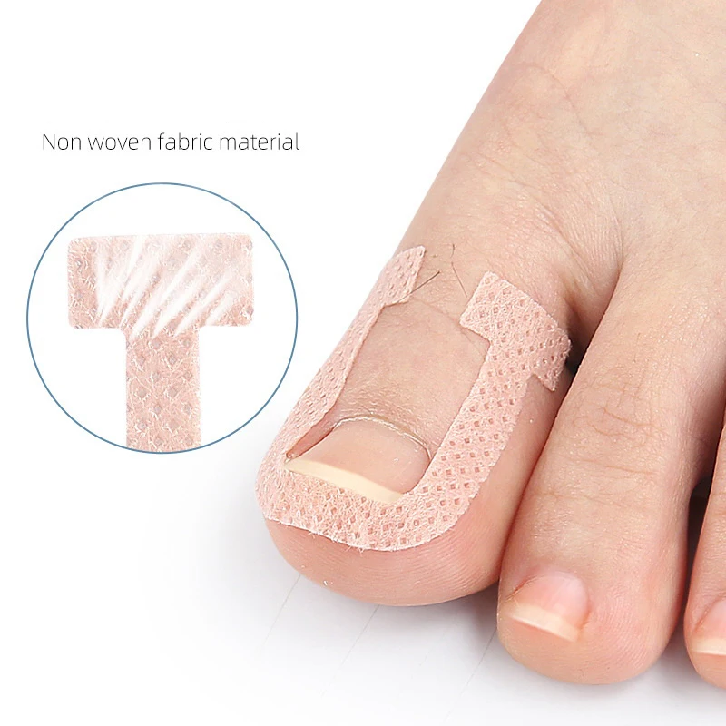 Patch Adhésif pour Ongles Incarnés, Autocollant artificiel astique de Traitement des Ongles, Outils de Soins des Pieds, 4 Pièces/Feuille