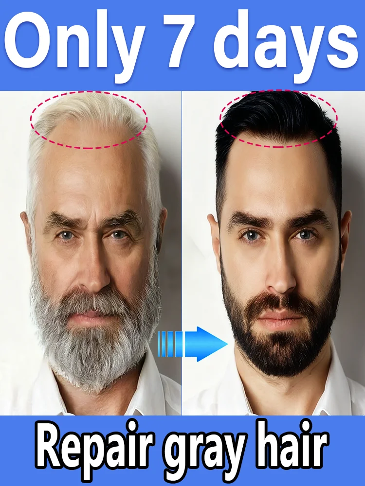 

White to Black Hair Serum Gʀᴀʏ Hᴀɪʀ Tʀᴇᴀᴛᴍᴇɴᴛ Nᴀᴛᴜʀᴀʟ Cᴏʟᴏʀ Rᴇᴘᴀɪʀ Nᴏᴜʀɪsʜɪɴɢ Aɴᴛɪ-Hᴀɪʀ Lᴏss Cᴀʀᴇ Mᴇɴ Wᴏᴍᴇɴ