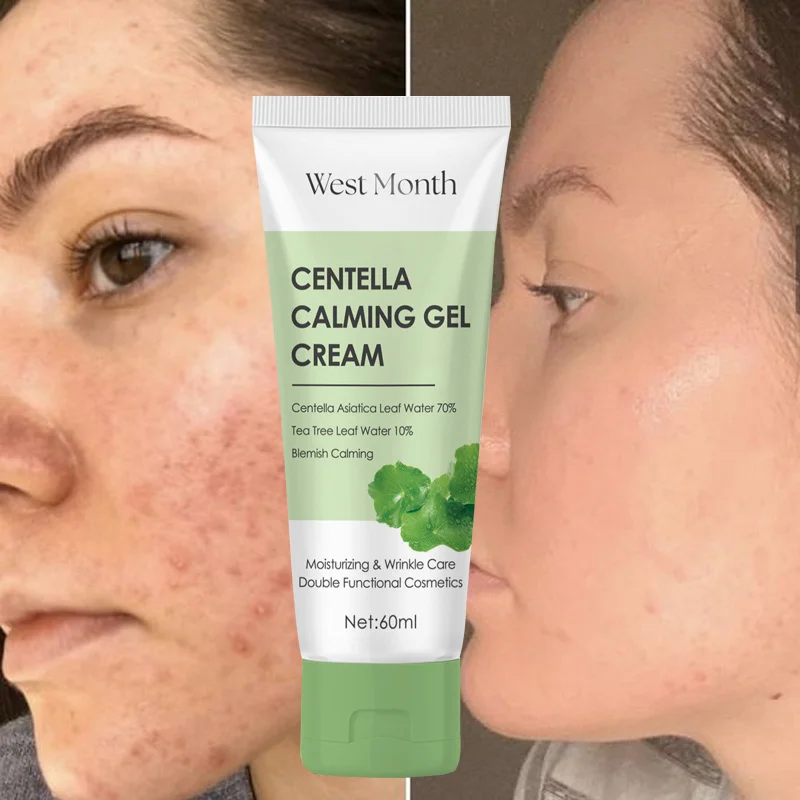 

Lasting Lasting Nourishing Centella Asiatica Moisturizing Cream Brightens Tightens Skin Tone Reduces Fine Lines Korean Face Care