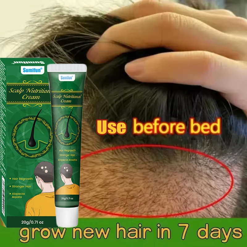 Fast Ginger Hair Growth Cream Anti Hair Loss Baldness Repair Damaged Scalp Treatment Nourish Hair Root Care Products Women Men