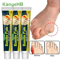 3Pcs Foot Gout Treatment Cream Thumb Corrector Finger Hallux Ointment Toe Bunion Pain Relieve Medical Plaster Health Care A1790