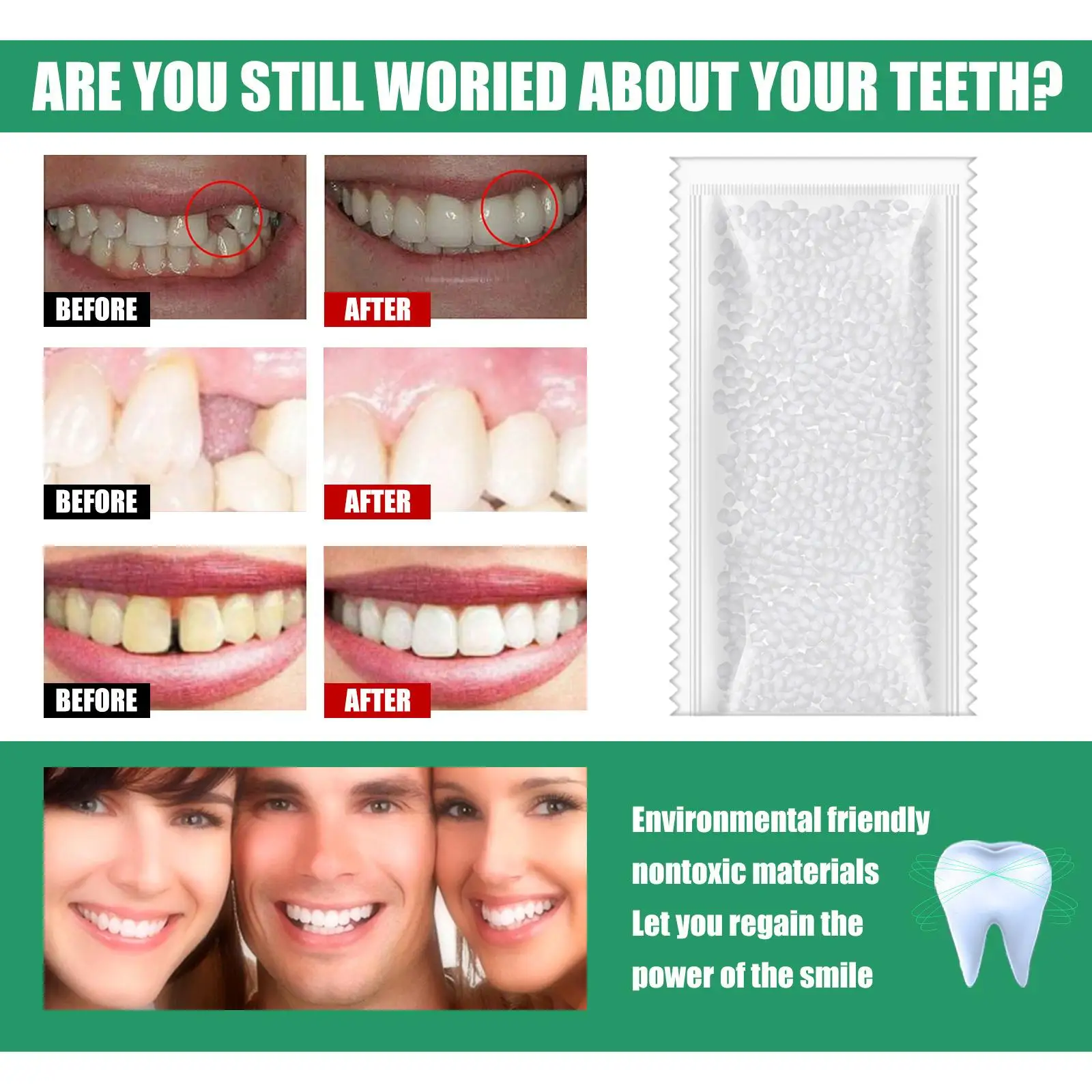 Teeth Repair Kit Self-repair Thermoplastic Filling Bead Set Dental Materials for Missing or Uneven Teeth Replacement