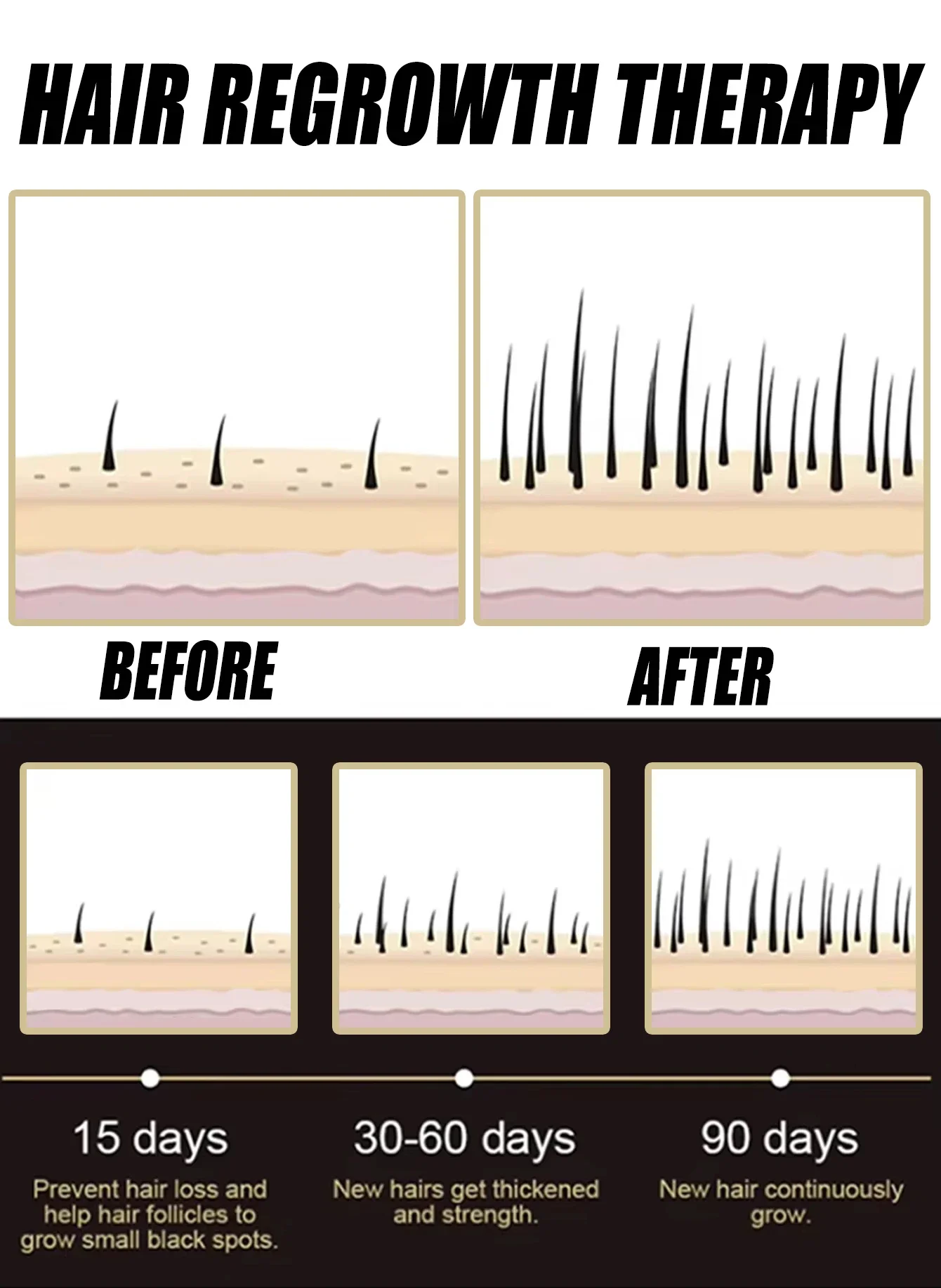 Anti-hair Loss Essence Promotes Hair Growth and Improves The Scalp Environment