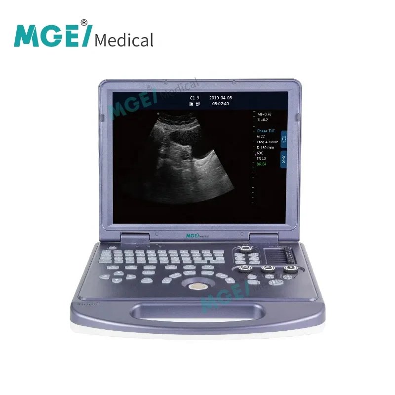 MEDIGE UMWD36 China Medical Instruments Multiprobe Sonography Human B/W Ultra Sound Scan 2D Laptop Ultrasound Machine Portable