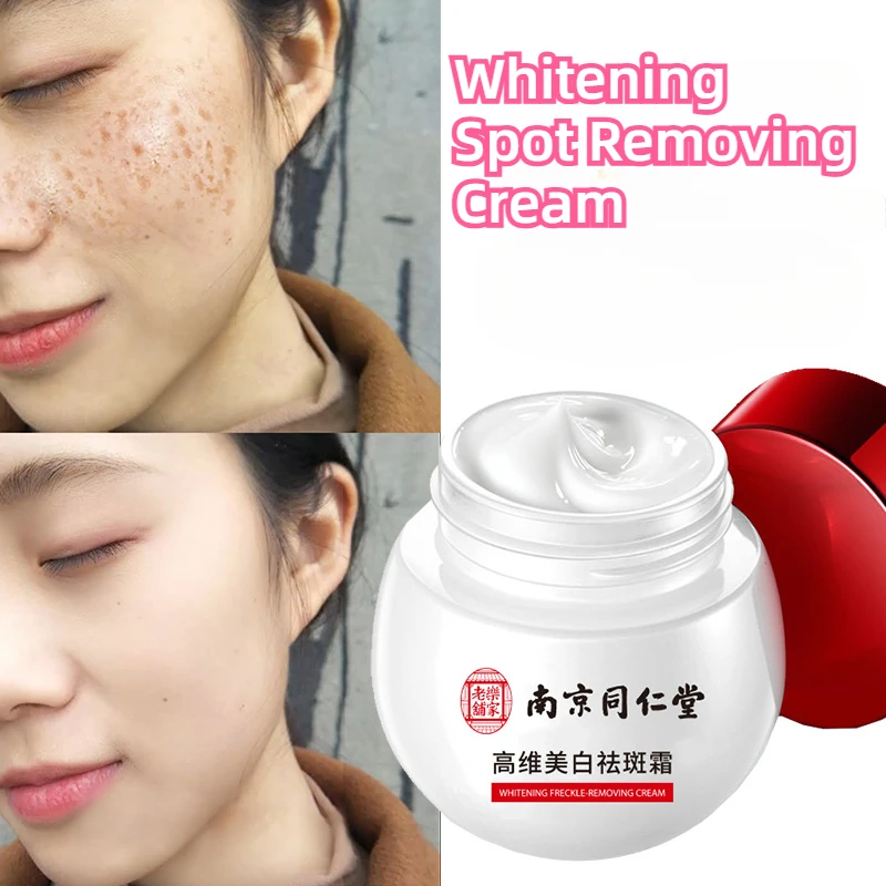 Whitening and Freckle Cream, Spot Removal, Light Spot Removal, Moisturizing and Whitening Cream for Men and Women