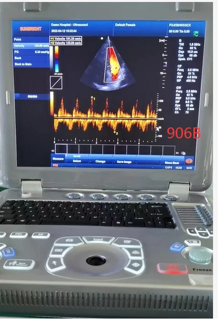 Диагностическая ультразвуковая система типа ноутбук, Цветной Допплер 3D/4D Режим CW PW