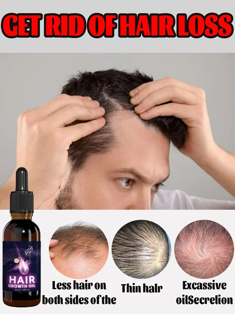 

Эфирное масло для роста волос. Эффективно восстанавливает облысение и выпадение волос симптомы