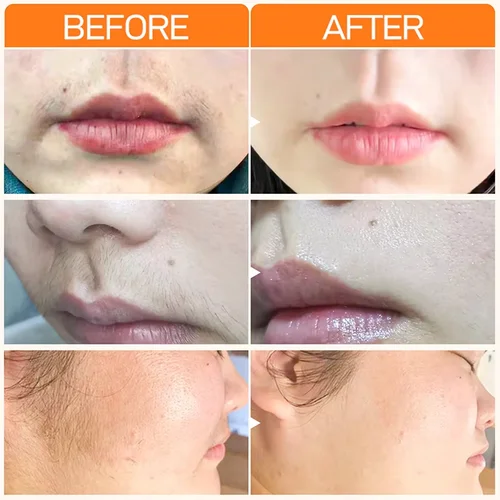 Imagen 2 del producto Crema de depilación rápida de 3 minutos, inhibidor indoloro del crecimiento del cabello, labio, cara, brazo, axila, pierna, depilatorio permanente para hombres y mujeres, cuidado