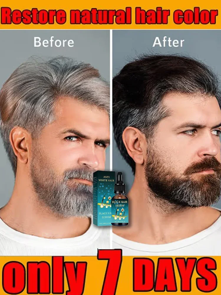 White hair killer, remove gray hair and restore natural hair color in 7 days Healthy,quickly turns white airh into black