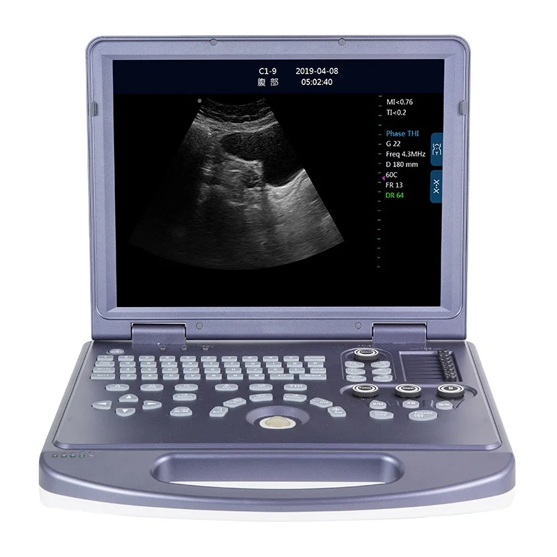 

portable ultrasound scanner PC Platform Full-digital Ultrasound Diagnostic System Ultrasound Machine