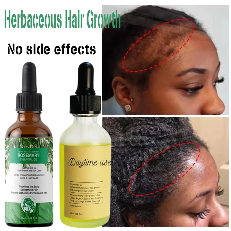 

herb Hair Growth Serum Fast Growing Hair Essential Oil Beauty Hair Care Anti-Hair Loss Essence Natural Repair Damaged Hair