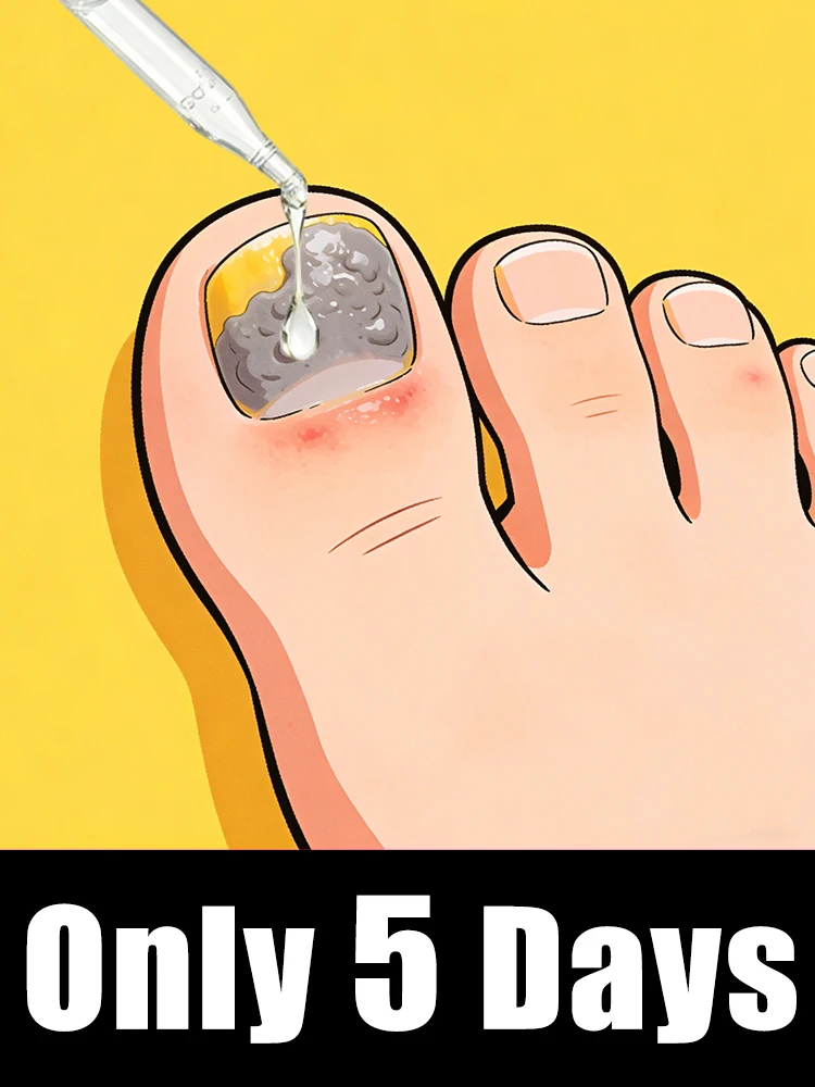 

Plastic Hand & Foot Nail Brushes Dust Cleaner Manicure Pedicure Care Tool Kit