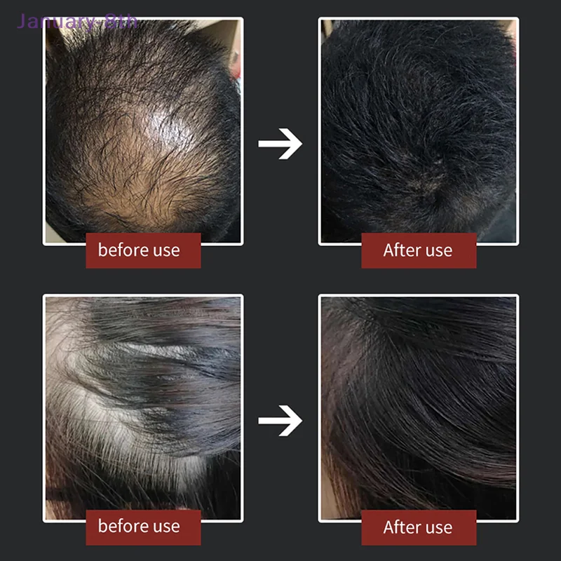 Hair Fibers Powder Special Comb Hair Loss Building Fibers Hair Line Optimizer Hair Thickening Fibers