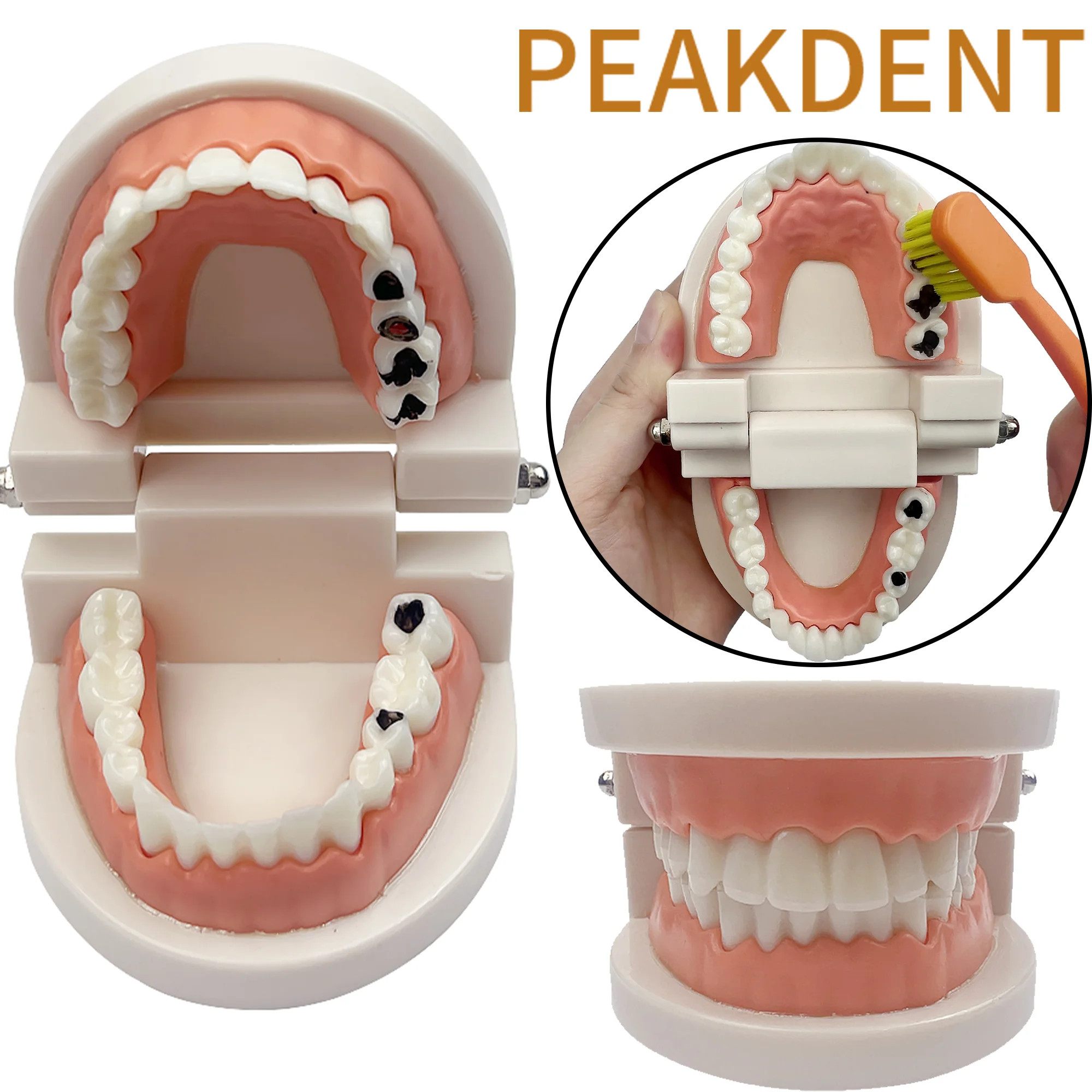 

Dental Education Model With Caries Tooth Standard Teeth Model Oral Hygiene Studying Teaching Demonstration Dentistry Products