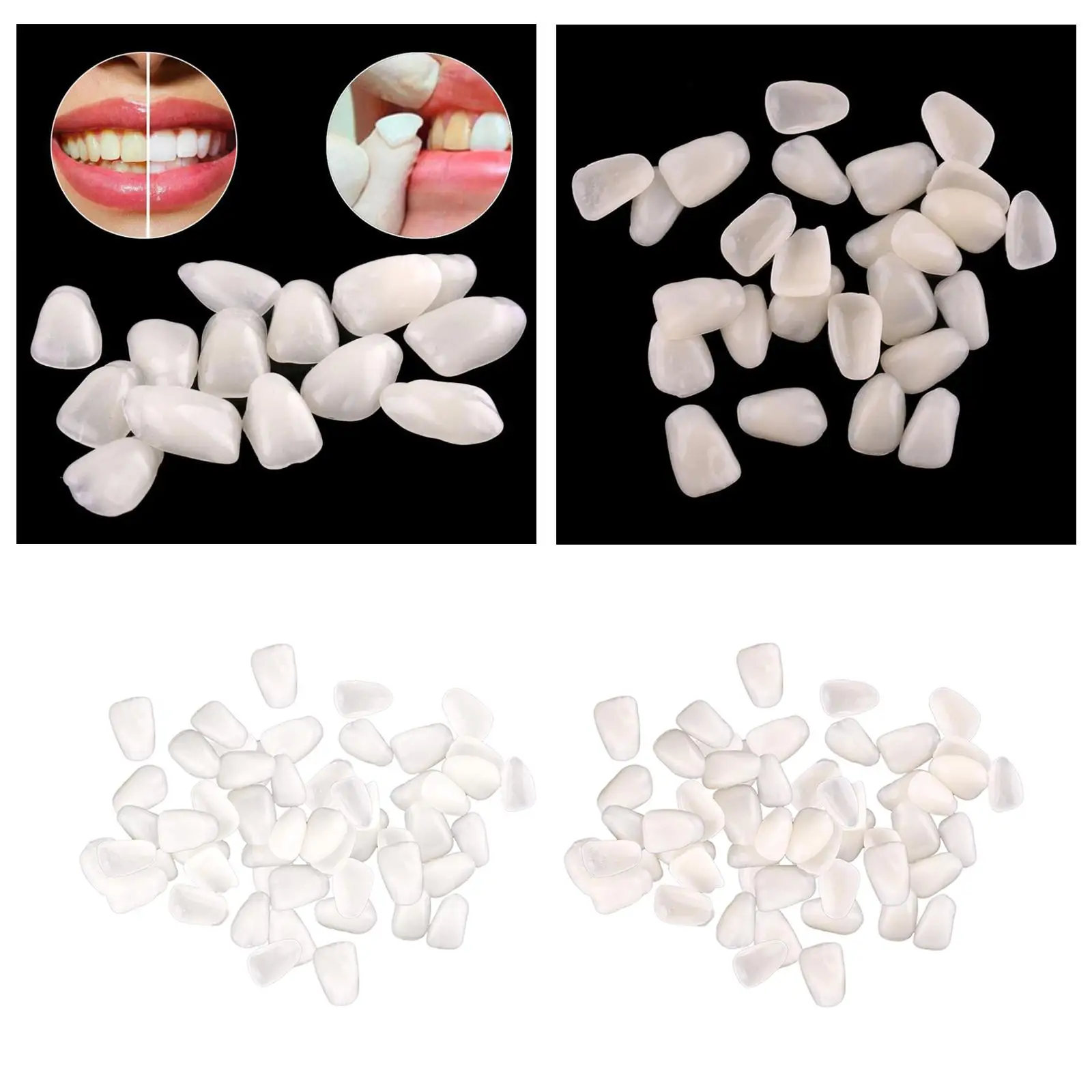 Dental Tooth Temporary Veneers Upper Anterior Front Resin