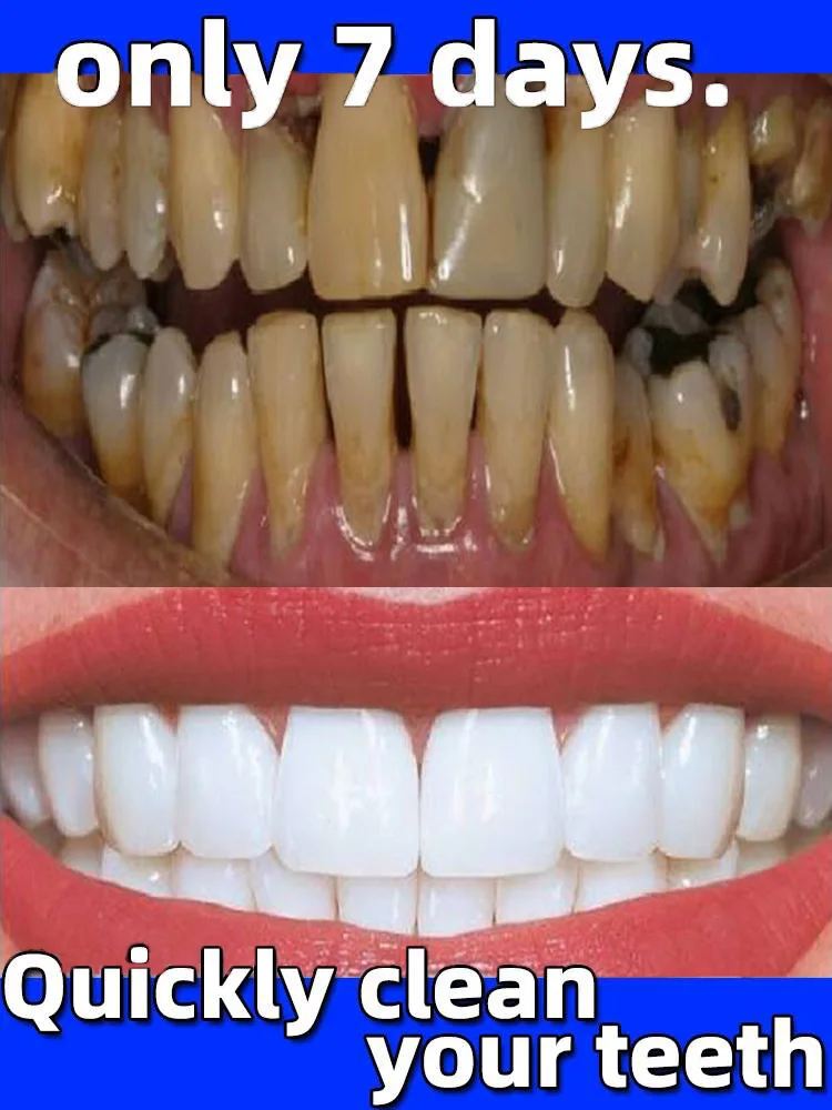 

Tartar removers dissolve tartar and remove stains bad breath remover easily