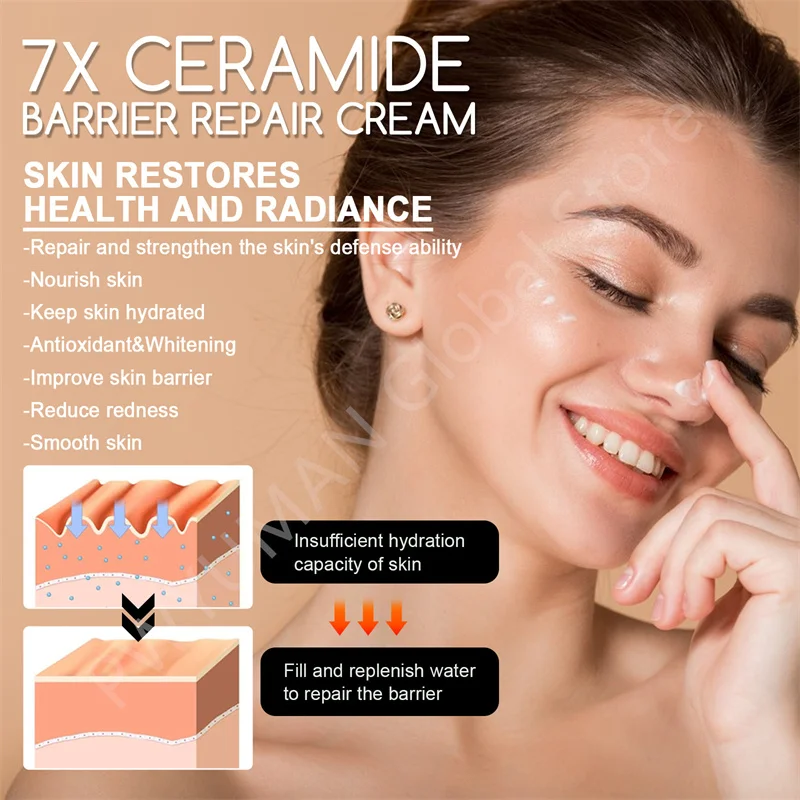 Ceramide Barrier Repair Cream, Facial Calmante, Loção Vermelhidão, Rosema, Sangue Vermelho, Melhorar a Pele Seca e Sensível, Hidratante, Novo, 7X,