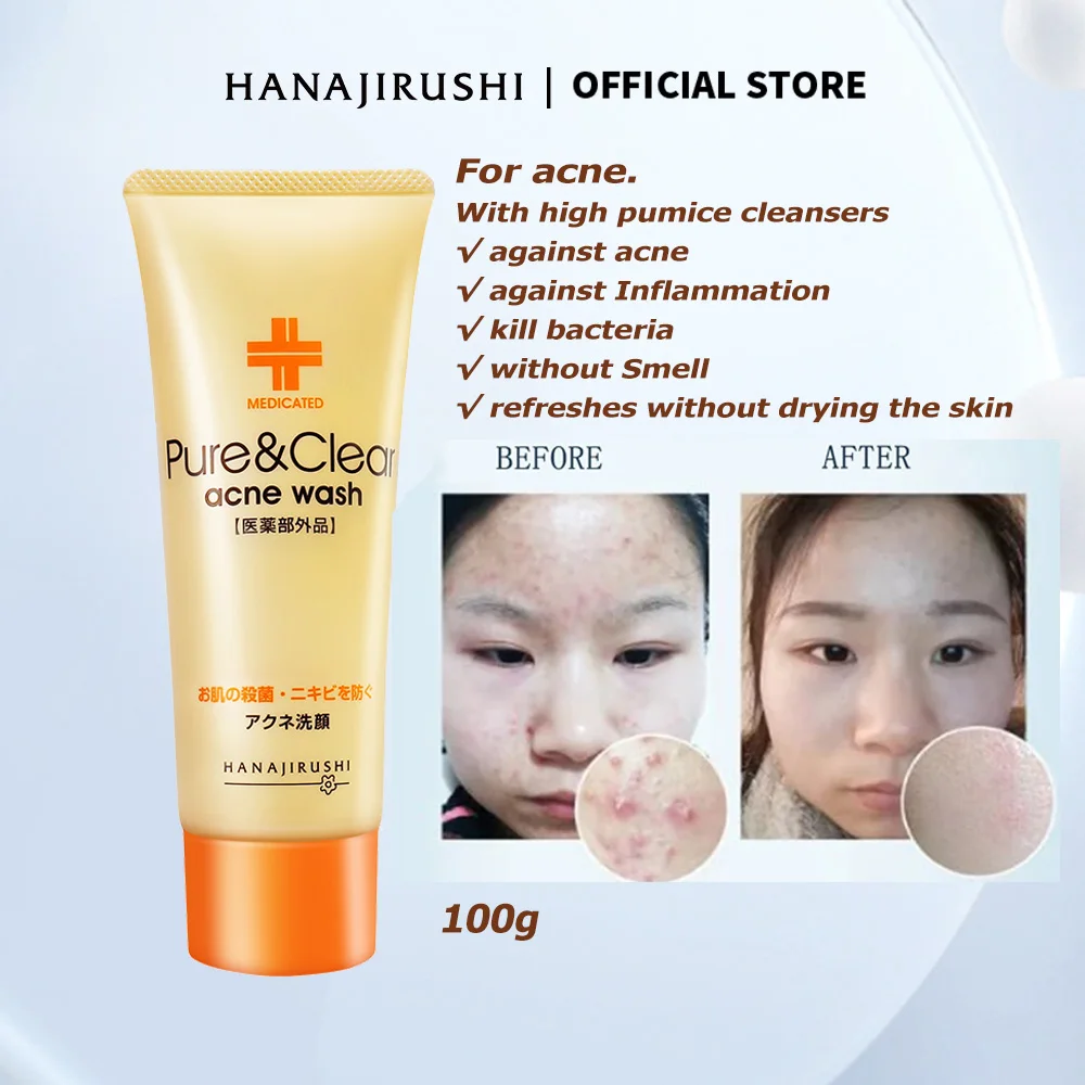 HANAJIRUSHI Acne Treatment Cleanser Remove Acne Face Wash Medicated Clear Facial Cleanser 60g