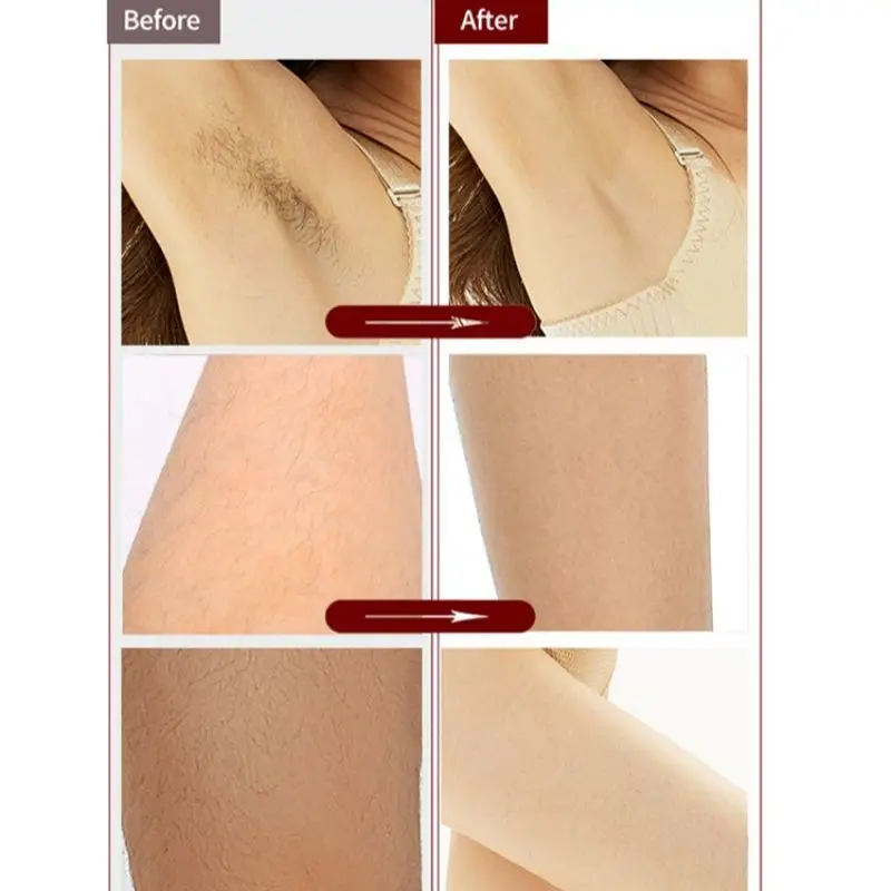 คิ้วไฟฟ้าTrimmer Facial Hair Removerเครื่องโกนหนวดผู้หญิงผลิตภัณฑ์แต่งหน้าสําหรับผู้หญิงไม่เจ็บปวดความปลอดภัยชาร์จUSBสําหรับAll Body